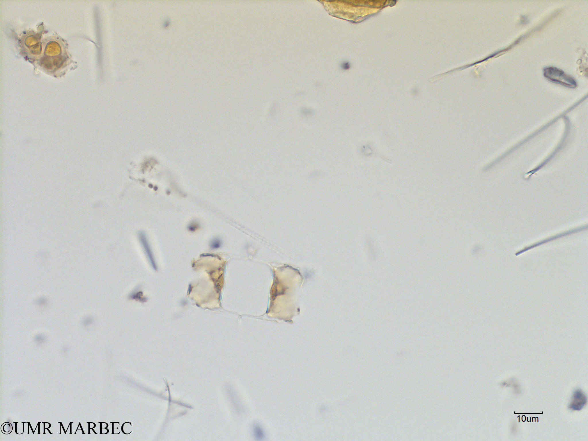 phyto/Scattered_Islands/mayotte_lagoon/SIREME May 2016/Chaetoceros distans (old C. sp36 -MAY5_chaetoceros a-3).tif(copy).jpg